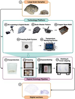 A technology platform for standardized cryoprotection and freezing of large-volume brain tissues for high-resolution histology